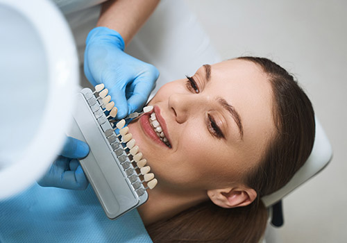 Dental Veneers