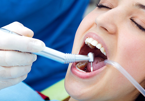 Dental Implant
